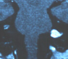 mri image