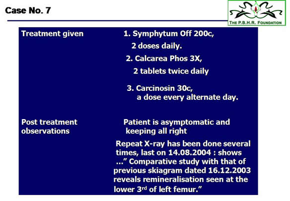 banerji protocol symphytum 200 for fibromyalgia